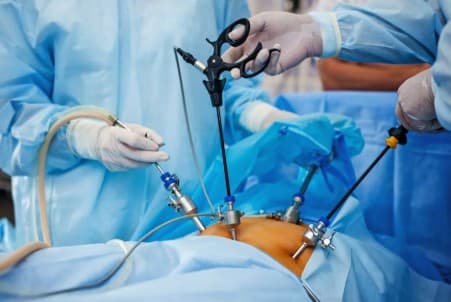Laparoscopic Surgery Setup