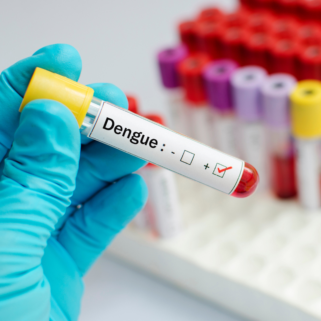 Dengue Treatment